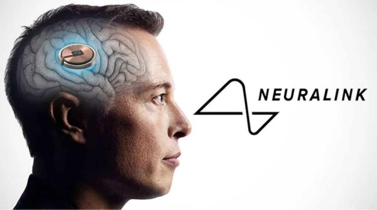 脳にチップを埋め込む時代が到来。ニューラリンクが2026年に大量生産と自動手術を開始